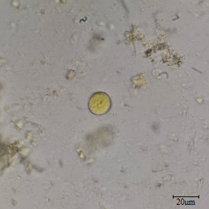 Cisto de Entamoeba