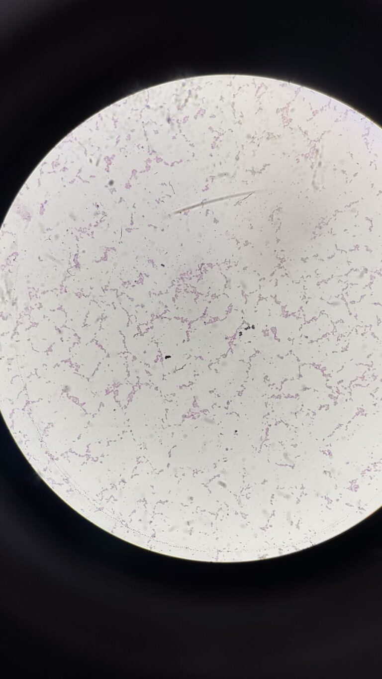 Escherichia coli002