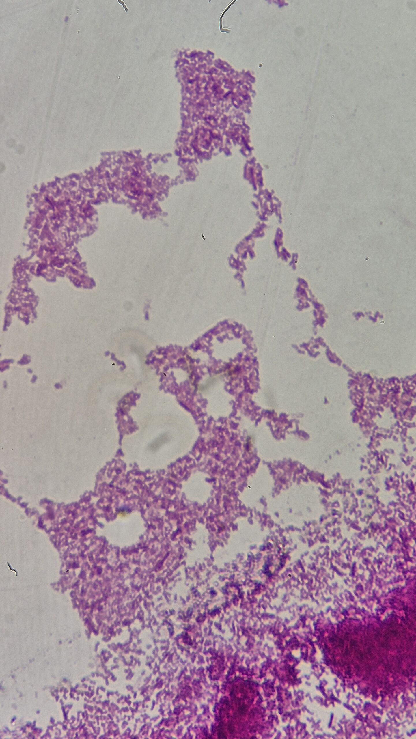 Escherichia coli