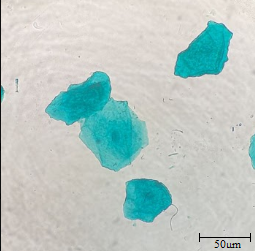 Queratinócito