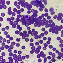 Eosinófilo