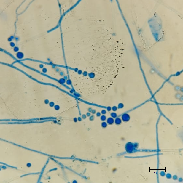 Monascus sp.
