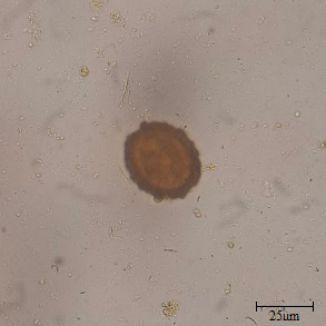 Ovo de Ascaris Lumbricoides